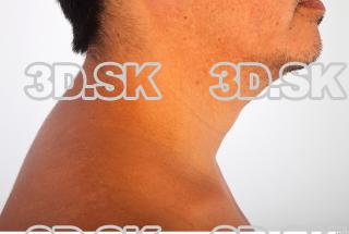 Neck photo reference 0003